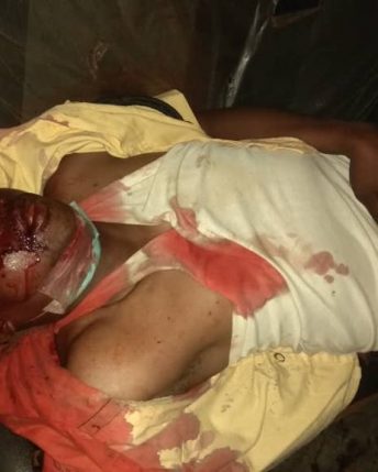 Irate mob kills FSARS officer who shot and killed LASTMA officer