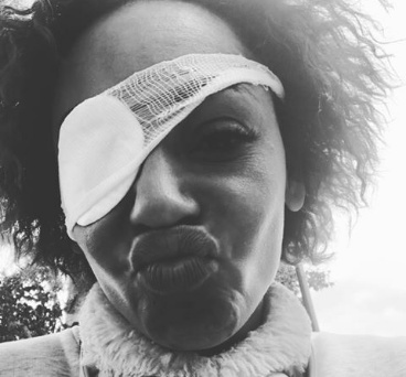 Mel B slams reports she has suffered eye inflammation before now