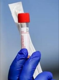 NCDC Report 117 New Cases As Total Infected Patients Hit 782