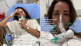 Kyle Richards: RHOBH Star Hospitalised After Bee Attack