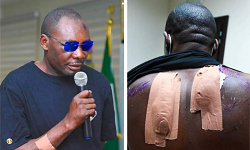 Bayelsa Commissioner Federal Otokito Regains Freedom