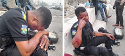 Police Officer Injured In Hit-And-Run Collision In Lagos