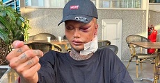 Levi Jed Murphy: TikToker Unveils Face Results After Getting 5 Plastic Surgery Procedures