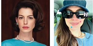 Anne Hathaway Wears Pimple Patches In New Selfie